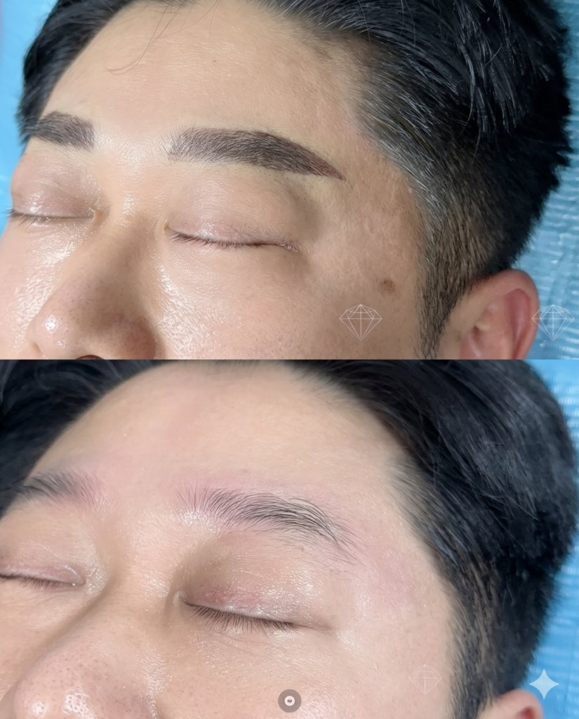 반영구화장 시술사진 b&f 부평눈썹문신전문지이엠뷰티 (17)